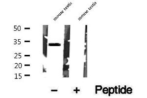 Western blot analysis of extracts of mouse testis tissue, using Syntaxin 17 antibody. (Syntaxin 17 抗体  (C-Term))