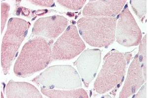 Human Skeletal Muscle (formalin-fixed, paraffin-embedded) stained with XK antibody ABIN462089 followed by biotinylated goat anti-rabbit IgG secondary antibody ABIN481713, alkaline phosphatase-streptavidin and chromogen. (Membrane transport protein XK (XK) (AA 22-38) 抗体)