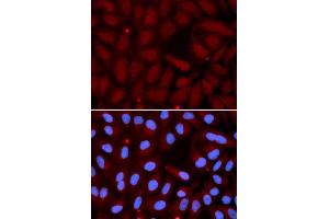 Immunofluorescence analysis of U2OS cell using SFTPC antibody.