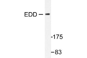 Image no. 1 for anti-Ubiquitin Protein Ligase E3 Component N-Recognin 5 (UBR5) antibody (ABIN271946) (UBR5 抗体)