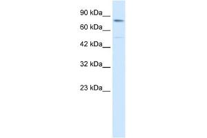 WB Suggested Anti-ZNF341 Antibody Titration: 0. (ZNF341 抗体  (Middle Region))