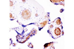 IHC(P): Human Placenta Tissue