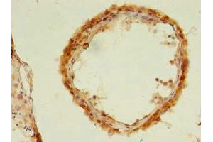 Immunohistochemistry of paraffin-embedded human testis tissue using ABIN7174516 at dilution of 1:100 (UBLCP1 抗体  (AA 2-318))