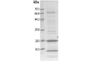 Recombinant TRIM33 (959-1069) protein gel.