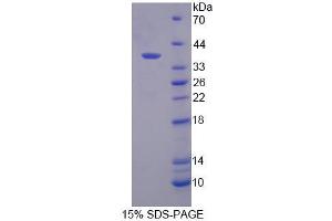 SDS-PAGE analysis of Human RGS9 Protein. (RGS 蛋白)