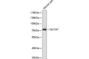 Western blot analysis of extracts of mouse eye, using SLC1 antibody (ABIN6129470, ABIN6147878, ABIN6147879 and ABIN6214419) at 1:1000 dilution. (SLC1A7 抗体  (AA 115-220))