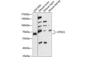 Western blot analysis of extracts of various cell lines, using CPNE3 antibody (ABIN7266500) at 1:1000 dilution. (Copine III 抗体  (AA 238-537))