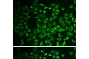 Immunofluorescence analysis of A549 cells using FABP6 Polyclonal Antibody (FABP6 抗体)