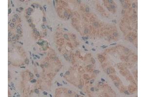 DAB staining on IHC-P; Samples: Human Kidney Tissue (WNT2 抗体  (AA 26-360))