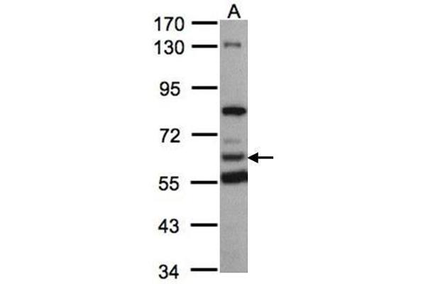 HACL1 抗体  (C-Term)