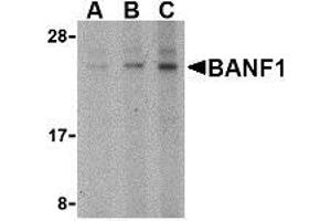 Western blot analysis of BANF1 in mouse kidney tissue lysate with AP30119PU-N BANF1 antibody at (A) 0. (BANF1 抗体  (N-Term))