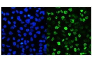 IF analysis of SMARCAD1 using anti-SMARCAD1 antibody (ABIN6719539).