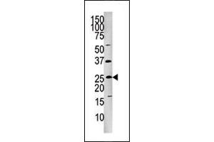 Image no. 1 for anti-Fas (TNFRSF6)-Associated Via Death Domain (FADD) (pSer191) antibody (ABIN358126) (FADD 抗体  (pSer191))