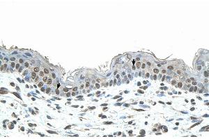 Immunohistochemistry (IHC) image for anti-SMAD, Mothers Against DPP Homolog 1 (SMAD1) (N-Term) antibody (ABIN2780719)
