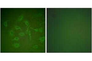 Immunofluorescence (IF) image for anti-Secretoglobin, Family 2A, Member 2 (SCGB2A2) (AA 41-90) antibody (ABIN2889220) (Mammaglobin A 抗体  (AA 41-90))