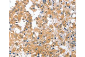 Immunohistochemistry (IHC) image for anti-Cerebellar Degeneration-Related Protein 2, 62kDa (CDR2) antibody (ABIN2423130) (CDR2 抗体)