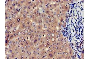 Immunohistochemistry of paraffin-embedded human liver tissue using ABIN7152188 at dilution of 1:100 (EIF4ENIF1 抗体  (AA 340-630))