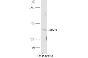 Mouse placenta lysates probed with Rabbit Anti-MAP4 Polyclonal Antibody, Unconjugated (ABIN754243) at 1:300 overnight at 4˚C. (MAP4 抗体  (AA 701-800))