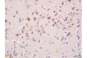 Formalin-fixed and paraffin embedded rat brain tissue labeled with Anti-Regucalcin/SMP30 Polyclonal Antibody, Unconjugated  at 1:200 followed by conjugation to the secondary antibody and DAB stainin (Regucalcin 抗体  (AA 65-160))