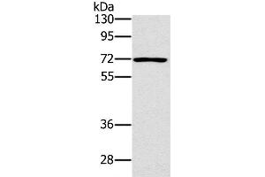 Western Blot analysis of Raji cell using PLS3 Polyclonal Antibody at dilution of 1:400 (Plastin 3 抗体)