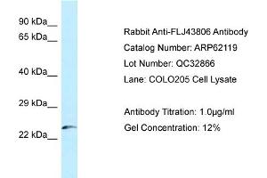 Western Blotting (WB) image for anti-Kazrin (KAZ) (N-Term) antibody (ABIN2781340) (Kazrin 抗体  (N-Term))