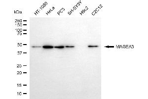Western blotting analysis using MAGEA3 antibody (ABIN7799357).