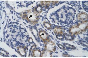 Human kidney; TRIM68 antibody - middle region in Human kidney cells using Immunohistochemistry (TRIM68 抗体  (Middle Region))