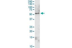 ALDH1A1 MaxPab rabbit polyclonal antibody.