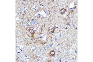 Immunohistochemistry of paraffin-embedded Mouse spinal cord using WWC1 Rabbit pAb (ABIN7271388) at dilution of 1:100 (40x lens). (WWC1 抗体  (AA 950-1050))