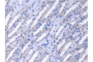 Detection of FUM in Mouse Kidney Tissue using Polyclonal Antibody to Fumarase (FUM) (FH 抗体  (AA 42-185))