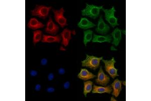 ABIN7094363 and ABIN7098410 staining HepG2 cells by IF/ICC. (STARD3 抗体  (Internal Region))