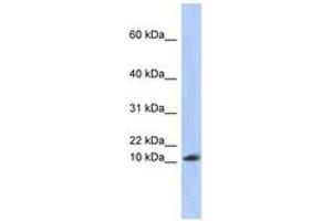 Image no. 1 for anti-Ribosomal Protein L30 (RPL30) (AA 35-84) antibody (ABIN6743983)