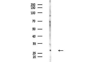 Western blot analysis of lysates from HepG2 cells(LPS, 4h treatment), using RNF144A Antibody at 1/1000 dilution.