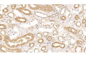 Immunohistochemistry (IHC) image for anti-Aconitase 1 (ACO1) (AA 251-443) antibody (ABIN7438541)