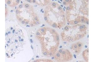 DAB staining on IHC-P; Samples: Human Kidney Tissue (ADAM9 抗体  (AA 440-680))