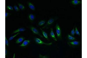 Immunofluorescent analysis of Hela cells using ABIN7164602 at dilution of 1:100 and Alexa Fluor 488-congugated AffiniPure Goat Anti-Rabbit IgG(H+L) (SLC17A4 抗体  (AA 14-57))