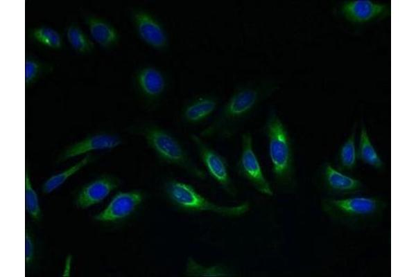 SLC17A4 Antikörper  (AA 14-57)