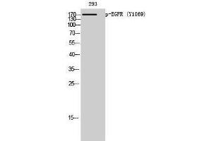 Western Blotting (WB) image for anti-Epidermal Growth Factor Receptor (EGFR) (pTyr1069) antibody (ABIN3182252) (EGFR 抗体  (pTyr1069))