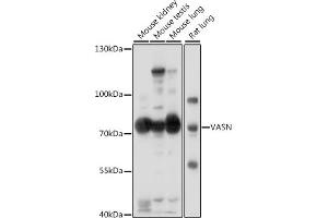 Western blot analysis of extracts of various cell lines, using VASN antibody (ABIN7271301) at 1:1000 dilution. (Vasn 抗体  (AA 420-575))
