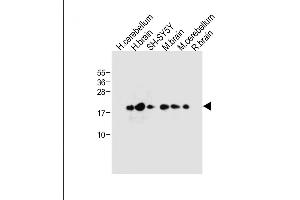 All lanes : Anti-FXYD6 Antibody (C-term) at 1:1000 dilution Lane 1: Human cerebellum tissue lysate Lane 2: Human brain tissue lysate Lane 3: SH-SY5Y whole cell lysate Lane 4: Mouse brain tissue lysate Lane 5: Mouse cerebellum tissue lysate Lane 6: Rat brain tissue lysate Lysates/proteins at 20 μg per lane. (FXYD6 抗体  (C-Term))