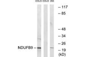 Western blot analysis of extracts from COLO205 cells/293 cells, using NDUFB9 Antibody.