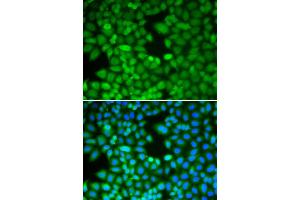 Immunofluorescence analysis of MCF-7 cell using RAN antibody. (RAN 抗体)