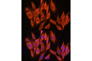 Immunofluorescence analysis of NIH-3T3 cells using PPM1A Rabbit pAb (ABIN6132507, ABIN6146039, ABIN6146040 and ABIN6222411) at dilution of 1:100 (40x lens). (PPM1A 抗体  (AA 1-382))