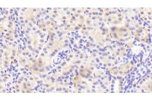 Detection of ITGa2 in Human Kidney Tissue using Polyclonal Antibody to Integrin Alpha 2 (ITGa2) (ITGA2 抗体  (AA 678-894))