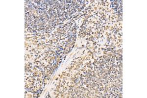 Immunohistochemistry of paraffin-embedded mouse spleen using SS18 Rabbit pAb (ABIN6133185, ABIN6148473, ABIN6148474 and ABIN6222754) at dilution of 1:100 (40x lens). (SS18 抗体  (AA 1-240))