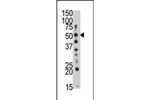 The GCNT1 polyclonal antibody  is used in Western blot to detect GCNT1 in mouse kidney tissue lysate . (GCNT1 抗体  (Internal Region))
