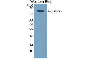 Western Blotting (WB) image for anti-Fc Fragment of IgG, Low Affinity IIIa, Receptor (CD16a) (FCGR3A) (AA 5-240) antibody (ABIN1858833) (FCGR3A 抗体  (AA 5-240))
