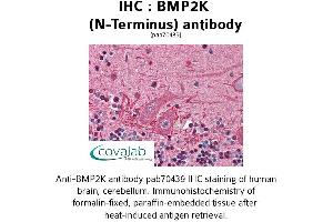 Image no. 1 for anti-BMP2 Inducible Kinase (BMP2K) (N-Term) antibody (ABIN1732361) (BMP2K 抗体  (N-Term))