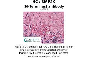 Image no. 1 for anti-BMP2 Inducible Kinase (BMP2K) (N-Term) antibody (ABIN1732361) (BMP2K 抗体  (N-Term))