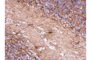 Immunohistochemistry (IHC) image for anti-Endosulfine alpha (ENSA) antibody (ABIN2855066)